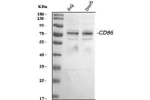 Western blot analysis of CD86 using anti-CD86 antibody (ABIN3042788).