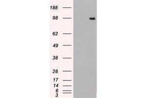 Image no. 10 for anti-TYRO3 Protein Tyrosine Kinase (TYRO3) antibody (ABIN1501605)