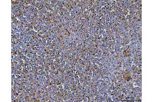 IHC analysis of MRC1 using anti-MRC1 antibody (ABIN7600593).