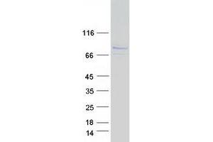 Validation with Western Blot