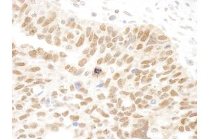anti-Family with Sequence Similarity 175, Member A (FAM175A) (AA 400-409) antibody