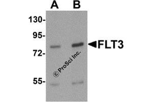 Western Blotting (WB) image for anti-Fms-Related tyrosine Kinase 3 (FLT3) (N-Term) antibody (ABIN1077372) (FLT3 抗体  (N-Term))