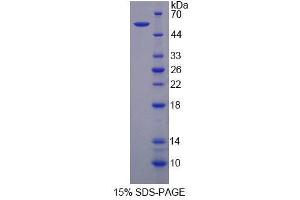 SDS-PAGE analysis of Human FARS2 Protein. (FARS2 蛋白)