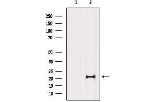 Western blot analysis of extracts from Mouse brain, using MED29 Antibody. (MED29 抗体  (Internal Region))