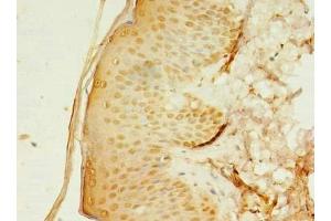 Immunohistochemistry of paraffin-embedded human skin tissue using ABIN7142992 at dilution of 1:100 (SMPDL3A 抗体  (AA 51-350))