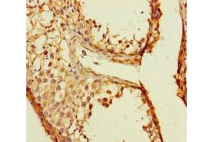 Immunohistochemistry of paraffin-embedded human testis tissue using ABIN7173143 at dilution of 1:100 (TMEM213 抗体  (AA 30-60))