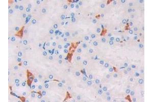 Used in DAB staining on fromalin fixed paraffin- embedded kidney tissue (UCP2 抗体  (AA 99-216))