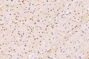 Immunohistochemistry analysis of paraffin-embedded rat heart using,SUN2 (ABIN7075502) at dilution of 1: 4000