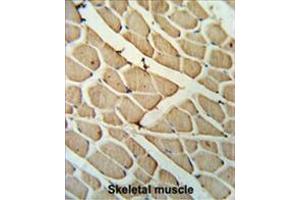 Immunohistochemistry (Paraffin-embedded Sections) (IHC (p)) image for anti-YTH Domain Family, Member 3 (YTHDF3) (AA 235-265), (Middle Region) antibody (ABIN955620)