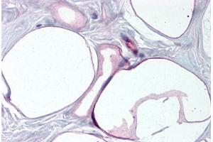 Human Breast, Adipocytes (formalin-fixed, paraffin-embedded) stained with FABP4 antibody ABIN790284 at 10 ug/ml followed by biotinylated goat anti-rabbit IgG secondary antibody ABIN481713, alkaline phosphatase-streptavidin and chromogen. (FABP4 抗体  (AA 103-118))