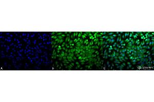 Immunocytochemistry/Immunofluorescence analysis using Rabbit Anti-p38 Polyclonal Antibody . (MAPK14 抗体  (FITC))