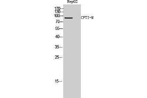 Western Blotting (WB) image for anti-Carnitine Palmitoyltransferase 1B (Muscle) (CPT1B) (Internal Region) antibody (ABIN3174542) (CPT1B 抗体  (Internal Region))