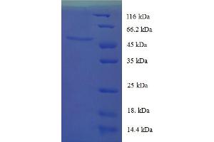 SDS-PAGE (SDS) image for Uncoupling Protein 1 (Mitochondrial, Proton Carrier) (UCP1) (AA 2-307) protein (His-SUMO Tag) (ABIN5710595)