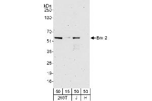 anti-POU Class 3 Homeobox 2 (POU3F2) (AA 393-443) antibody