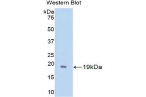 Detection of Recombinant GDNF, Mouse using Polyclonal Antibody to Glial Cell Line Derived Neurotrophic Factor (GDNF) (GDNF 抗体  (AA 79-217))