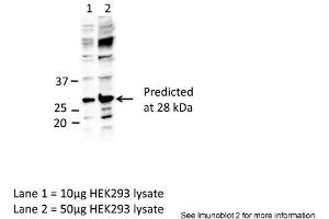 Sample Type: Lane1 = 10ug HEK293 lysateLane 2 = 50ug HEK293 lysatePrimary Antibody Dilution: Anti-EIF4E 1:1000Submitted By: Dr. (EIF4E 抗体  (C-Term))