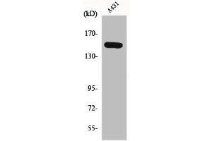 Western Blot analysis of A431 cells using Phospho-PLC β3 (S1105) Polyclonal Antibody (PLCB3 抗体  (pSer1105))