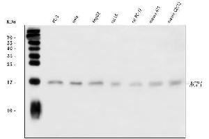 Western blot analysis of Acid phosphatase/ACP1 using anti-Acid phosphatase/ACP1 antibody (ABIN7599015).