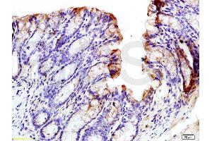 Formalin-fixed and paraffin embedded mouse intestine labeled with Rabbit Anti phospho-GCN2 (Thr667) Polyclonal Antibody, Unconjugated  at 1:200 followed by conjugation to the secondary antibody and DAB staining