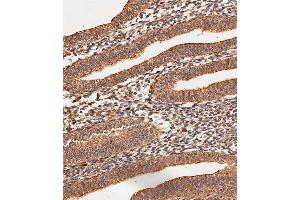 Immunohistochemistry (Paraffin-embedded Sections) (IHC (p)) image for anti-Collagen, Type V, alpha 1 (COL5A1) (AA 54-82), (N-Term) antibody (ABIN654444)