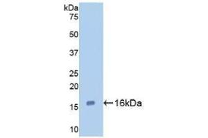 Detection of Recombinant GAL7, Human using Polyclonal Antibody to Galectin 7 (GAL7) (LGALS7 抗体  (AA 1-136))