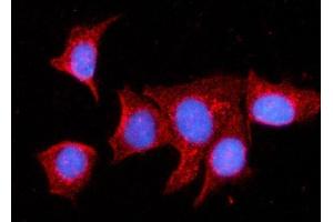 IF analysis of MDH2 using anti-MDH2 antibody (ABIN7602618).