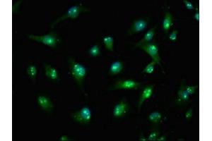 Immunofluorescence staining of U251 cells with ABIN7171462 at 1:100, counter-stained with DAPI. (TIAM2 抗体  (AA 1500-1627))