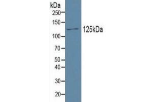 Mouse Capture antibody from the kit in WB with Positive Control: Human testis tissue. (PDGFRA ELISA 试剂盒)