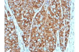 Immunohistochemistry (IHC) image for anti-Ribosomal Protein SA (RPSA) antibody (ABIN6939957)