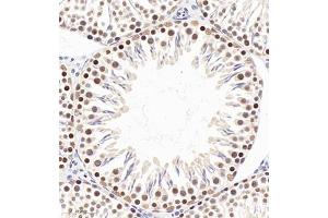 Immunohistochemistry of paraffin embedded rat testis using PP4R2 (ABIN7075284) at dilution of 1:2000 (320x lens) (PPP4R2 抗体)
