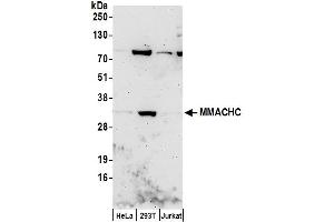 Western Blotting (WB) image for anti-Methylmalonic Aciduria (Cobalamin Deficiency) CblC Type, with Homocystinuria (MMACHC) (AA 175-225) antibody (ABIN7453270)