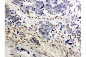 Immunohistochemistry (Paraffin-embedded Sections) (IHC (p)) image for anti-Nuclear Receptor Subfamily 3, Group C, Member 1 (Glucocorticoid Receptor) (NR3C1) (AA 20-199) antibody (ABIN3043371) (Glucocorticoid Receptor 抗体  (AA 20-199))