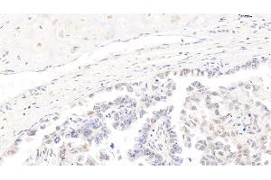 Immunohistochemistry (IHC) image for anti-Cyclin-Dependent Kinase 4 (CDK4) (AA 6-295) antibody (ABIN7433294)