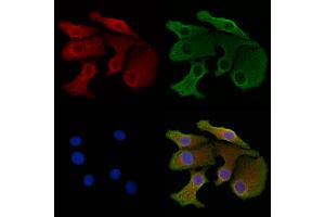 ABIN7094578 and ABIN7098627 staining Hela cells by IF/ICC.