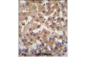 PREF6 Antibody (C-term) (ABIN655365 and ABIN2844922) immunohistochemistry analysis in formalin fixed and paraffin embedded human liver tissue followed by peroxidase conjugation of the secondary antibody and DAB staining. (PRAMEF6 抗体  (C-Term))