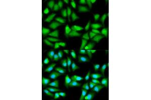 Immunofluorescence analysis of HeLa cell using GSS antibody. (Glutathione Synthetase 抗体  (AA 1-474))