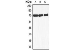 Western blot analysis of NCOA4 expression in MCF7 (A), mouse liver (B), rat lung (C) whole cell lysates. (NCOA4 抗体  (Center))