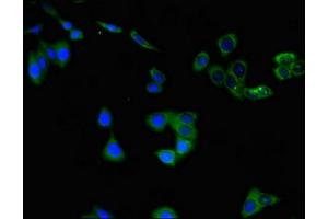 Immunofluorescent analysis of HepG2 cells using ABIN7147620 at dilution of 1:100 and Alexa Fluor 488-congugated AffiniPure Goat Anti-Rabbit IgG(H+L) (Choline Acetyltransferase 抗体  (AA 354-592))