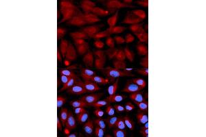 Immunofluorescence analysis of U2OS cells using CD70 antibody (ABIN5971064). (CD70 抗体)