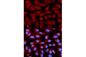 Immunofluorescence analysis of U2OS cells using CD70 antibody (ABIN5971064). (CD70 抗体)
