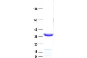Western Blotting (WB) image for E3 SUMO-Protein Ligase NSE2 (NSMCE2) protein (His tag) (ABIN2727651)