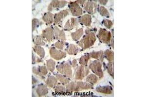 COCH Antibody (Center) immunohistochemistry analysis in formalin fixed and paraffin embedded human skeletal muscle followed by peroxidase conjugation of the secondary antibody and DAB staining. (COCH 抗体  (Middle Region))