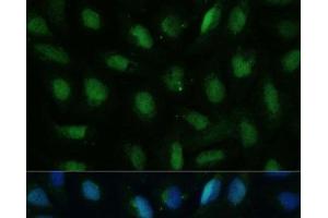 Immunofluorescence (IF) image for anti-Deoxyuridine Triphosphatase (DUT) antibody (ABIN7260715)