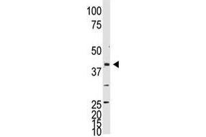Image no. 1 for anti-Neuronal Differentiation 1 (NEUROD1) (C-Term) antibody (ABIN357406) (NEUROD1 抗体  (C-Term))