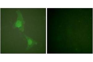 Immunofluorescence analysis of HeLa cells, using ADD1 (Ab-726) Antibody. (alpha Adducin 抗体  (AA 688-737))