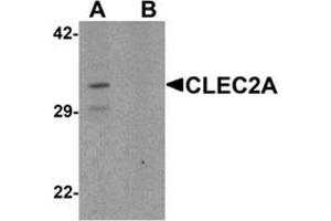 Western blot analysis of CLEC2A in K562 cell lysate with CLEC2A Antibody  at 1 ug/ml in (A) the absence and (B) the presence of blocking peptide. (CLEC2A 抗体  (N-Term))