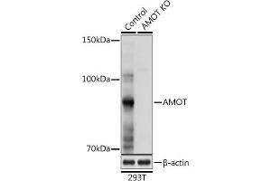 Western blot analysis of extracts from normal (control) and AMOT Rabbit pAb knockout (KO) 293T cells, using AMOT Rabbit pAb antibody (ABIN6128973, ABIN6136838, ABIN6136839 and ABIN6224101) at 1:1000 dilution. (Angiomotin 抗体  (AA 1-300))
