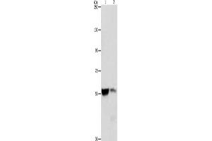 Gel: 8 % SDS-PAGE, Lysate: 40 μg, Lane 1-2: Mouse liver tissue, Mouse kidney tissue, Primary antibody: ABIN7128351(ALDH8A1 Antibody) at dilution 1/550, Secondary antibody: Goat anti rabbit IgG at 1/8000 dilution, Exposure time: 3 seconds (ALDH8A1 抗体)