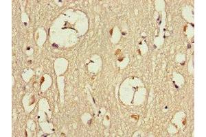 Immunohistochemistry of paraffin-embedded human brain tissue using ABIN7150100 at dilution of 1:100 (Dmx-Like 2 抗体  (AA 2471-2657))