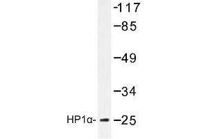 Image no. 1 for anti-Chromobox Homolog 5 (CBX5) antibody (ABIN272193) (CBX5 抗体)